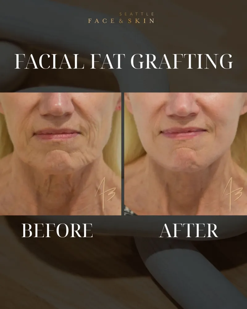 Before and after: Dr. Amit Bhrany