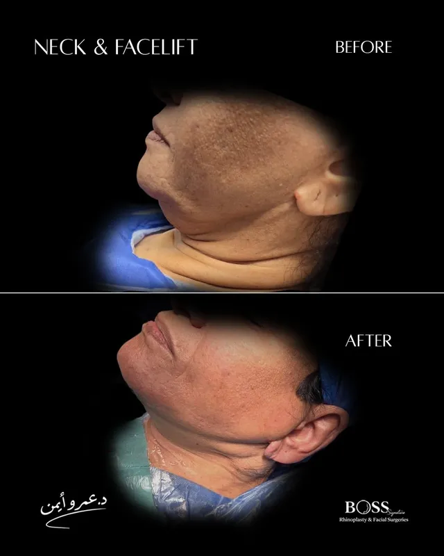 Before and after — Dr. Amr Ayman