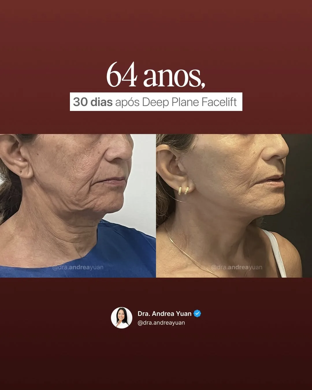 Before and after — Dr. Andrea Yuan