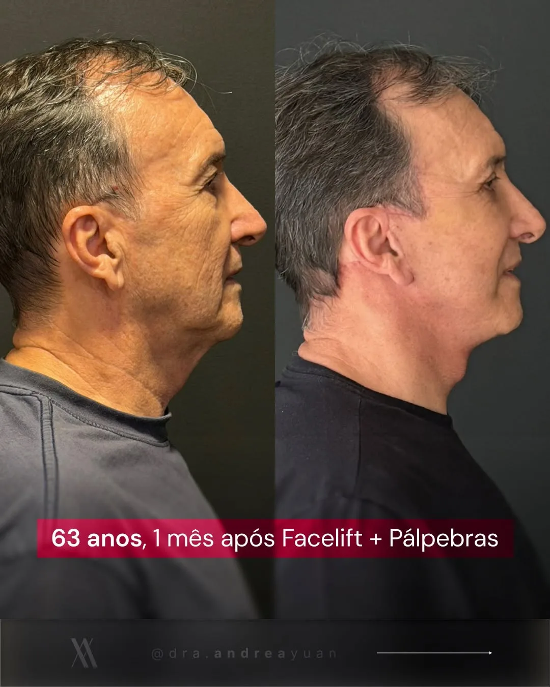 Before and after — Dr. Andrea Yuan