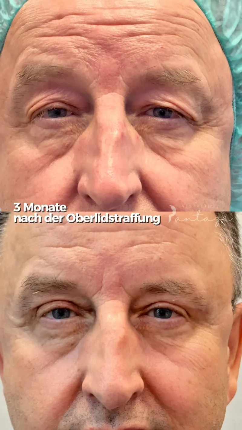 Before and after: Dr. Andrei-Teodor Pantazi