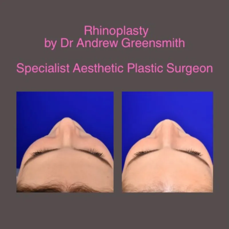 Before and after — Dr. Andrew Greensmith