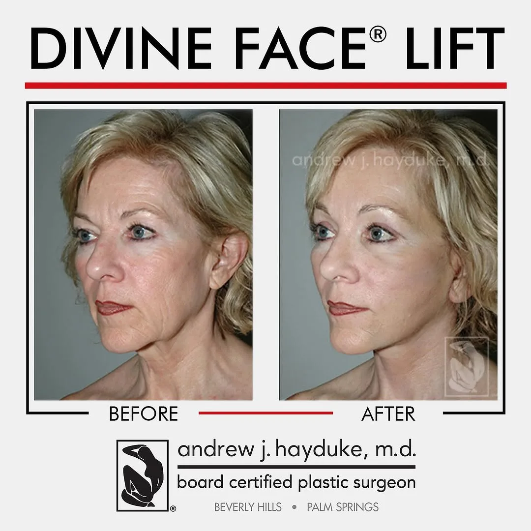 Before and after — Dr. Andrew J. Hayduke
