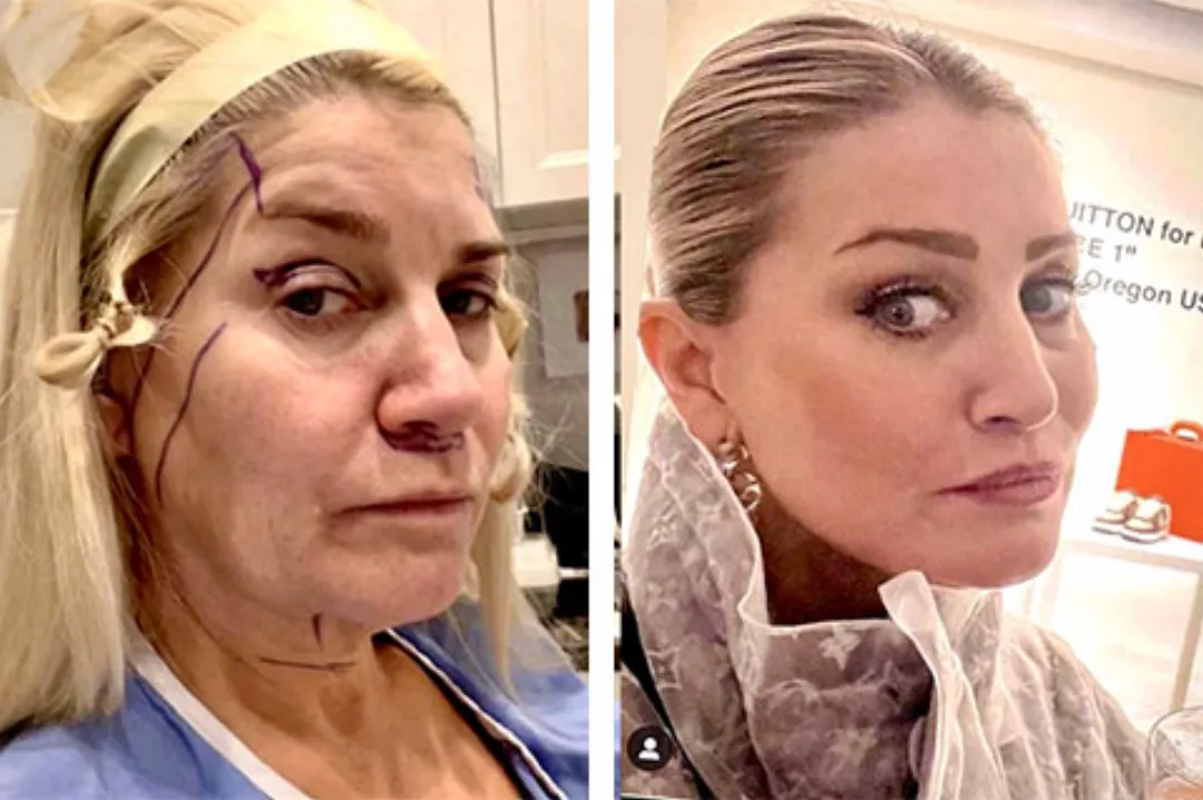 Before and after — Dr. Andrew Jacono