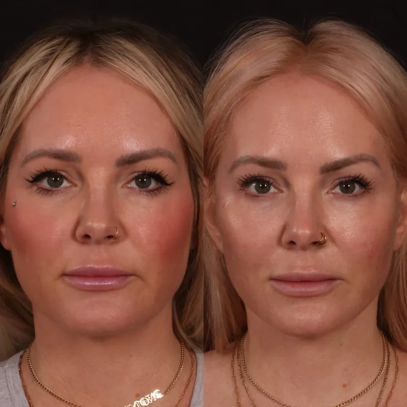 Before and after — Dr. Andrew Trussler