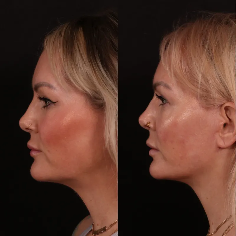 Before and after — Dr. Andrew Trussler