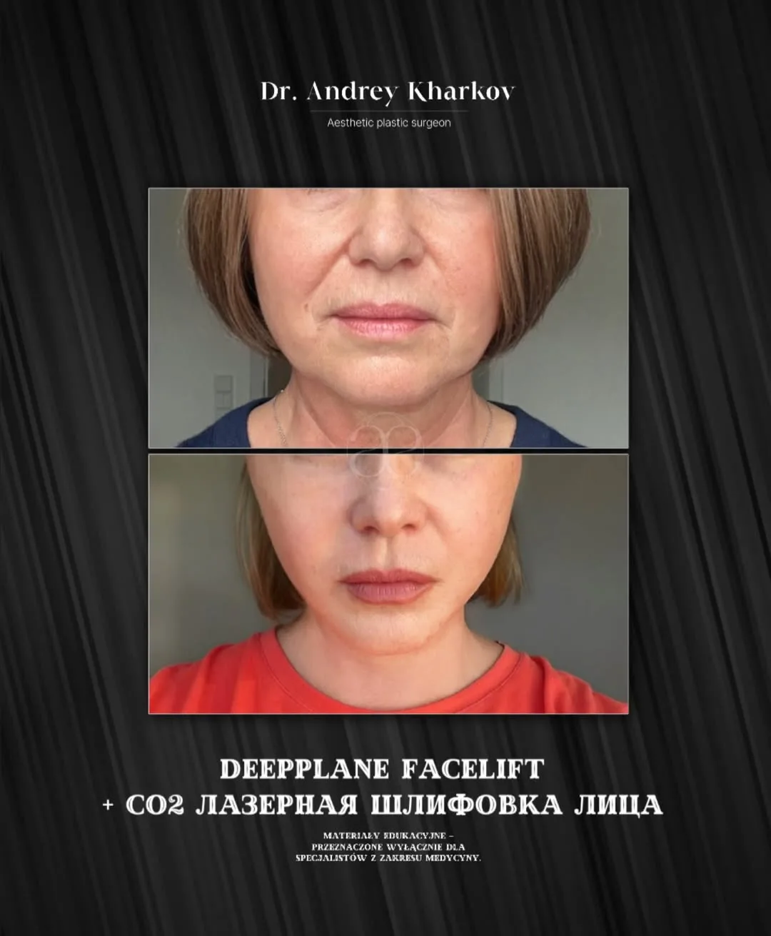 Before and after — Dr. Andrey Kharkov