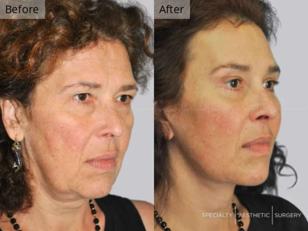 Before and after: Dr. Anna Frants