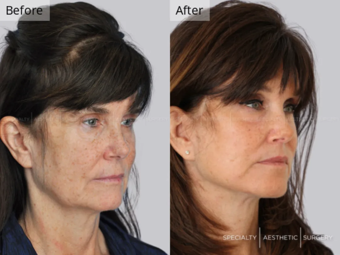 Before and after: Dr. Anna Frants