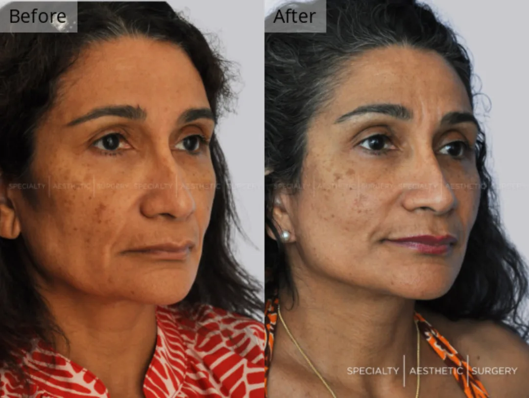 Before and after: Dr. Anna Frants