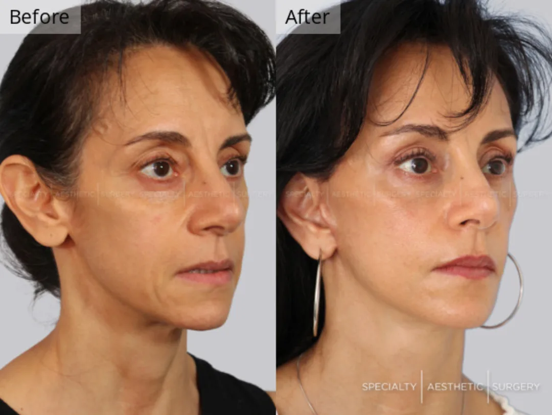 Before and after: Dr. Anna Frants