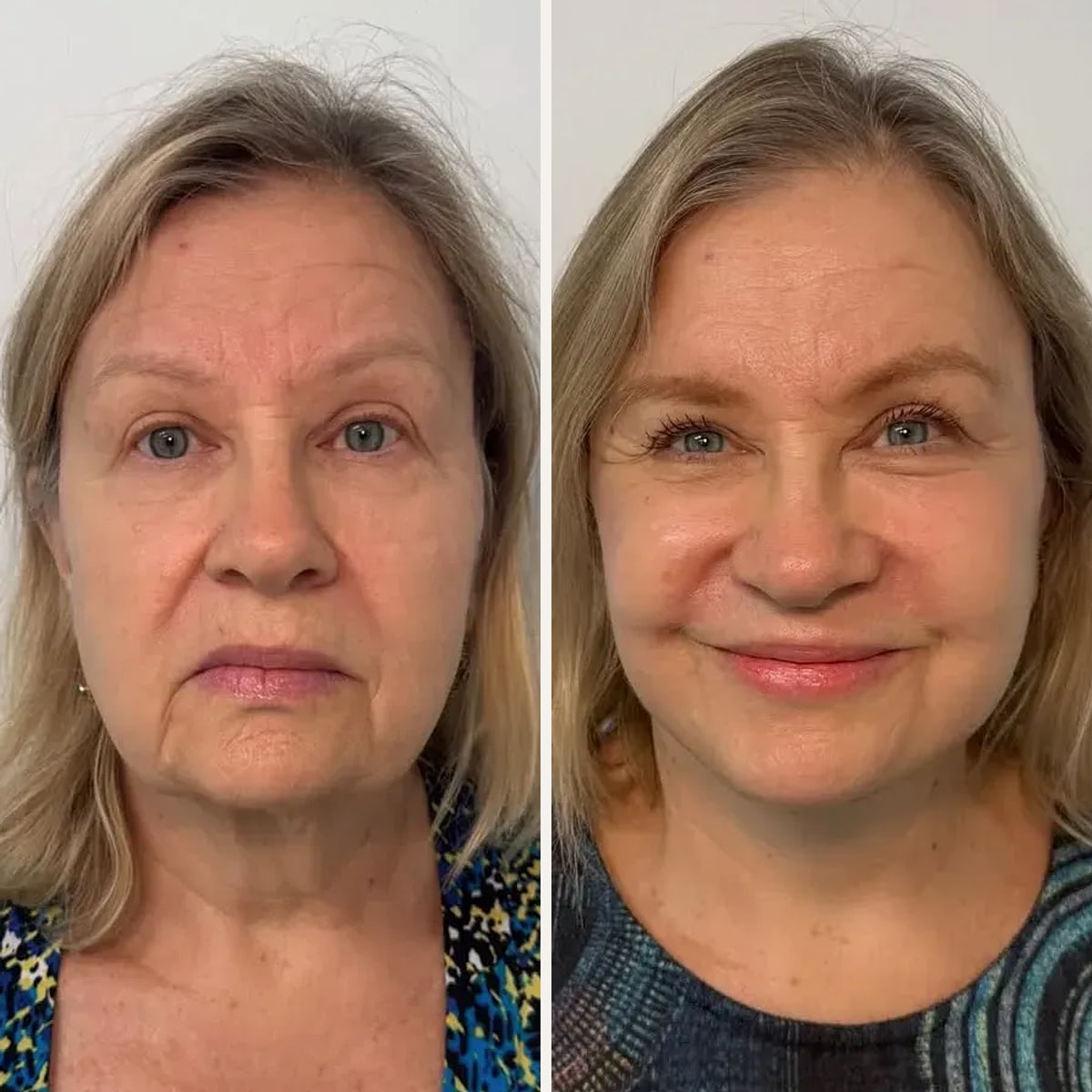 Before and after: Dr. Anthony C. Nichols