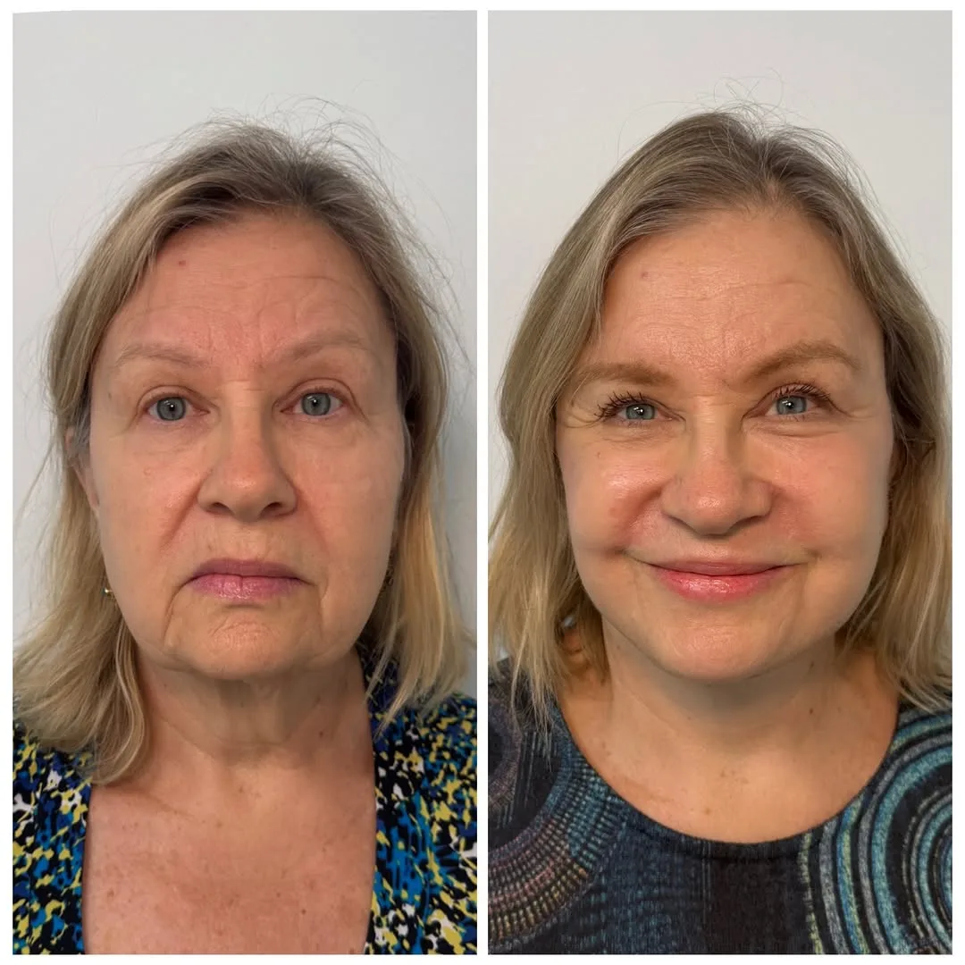 Before and after — Dr. Anthony C. Nichols