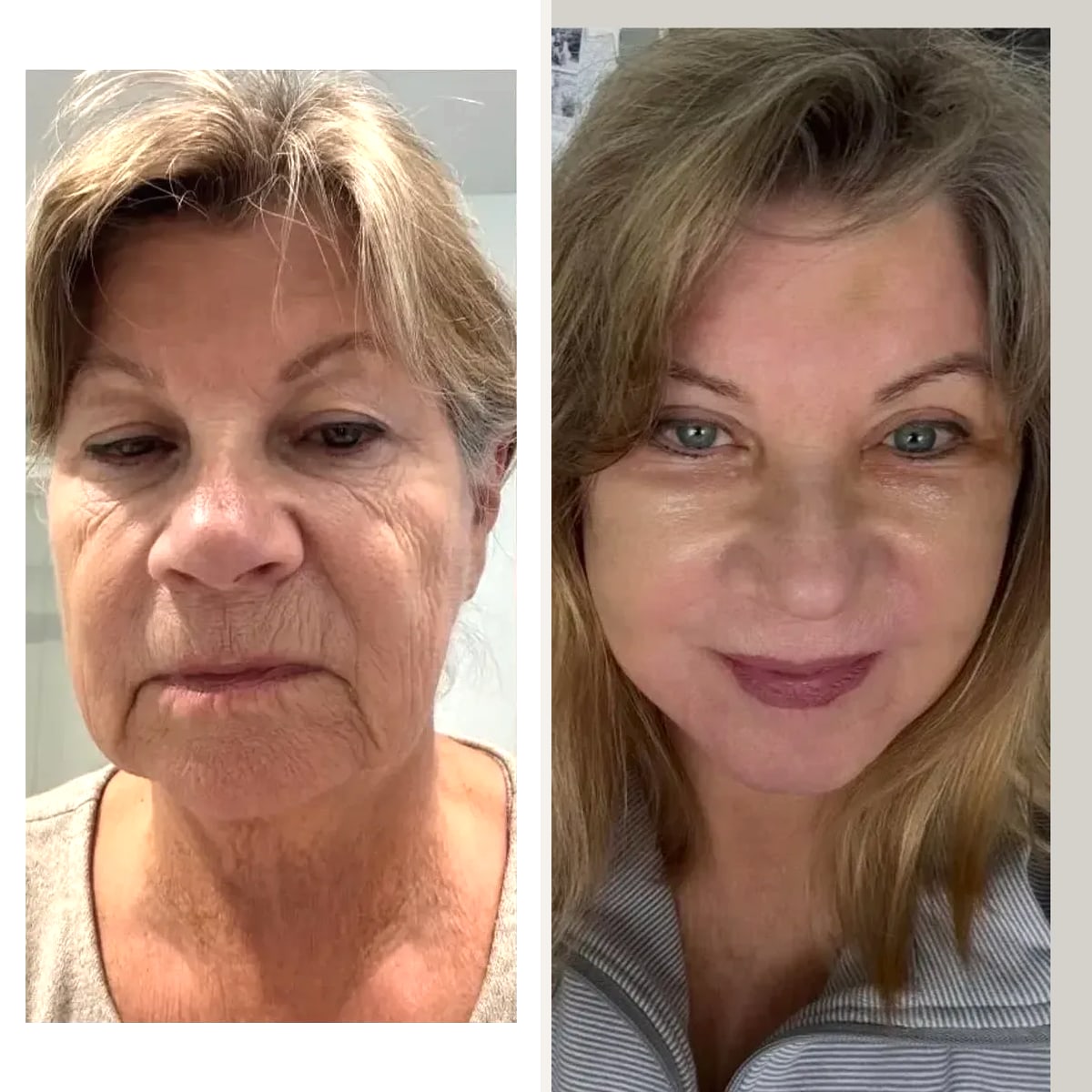 Before and after: Dr. Anthony C. Nichols