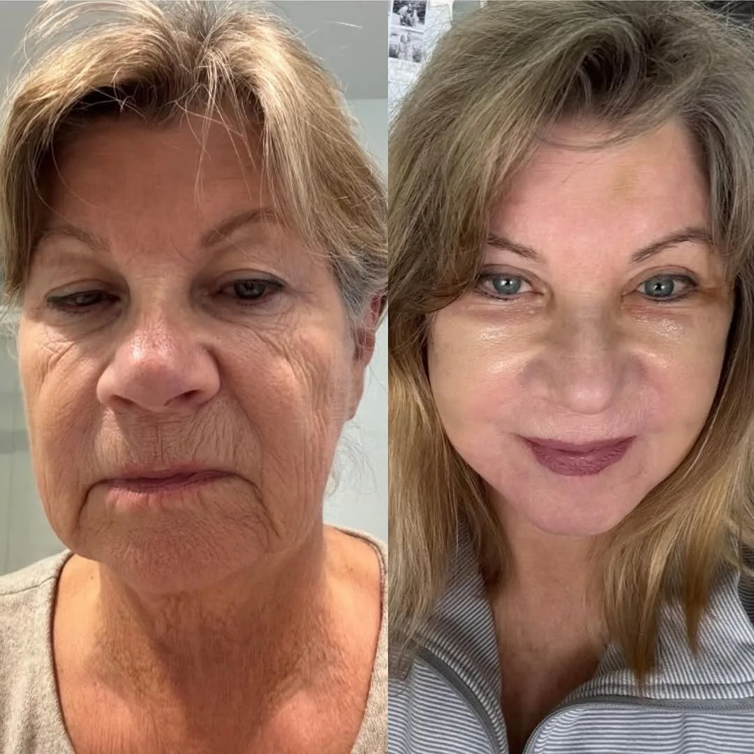 Before and after — Dr. Anthony C. Nichols