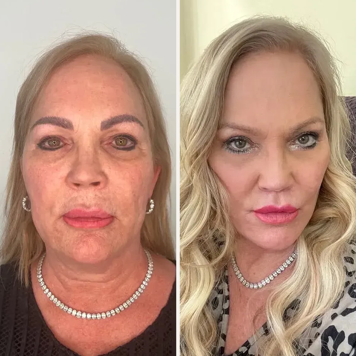 Before and after: Dr. Anthony C. Nichols