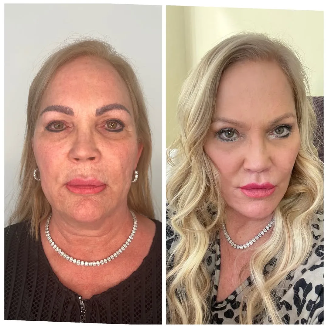 Before and after — Dr. Anthony C. Nichols