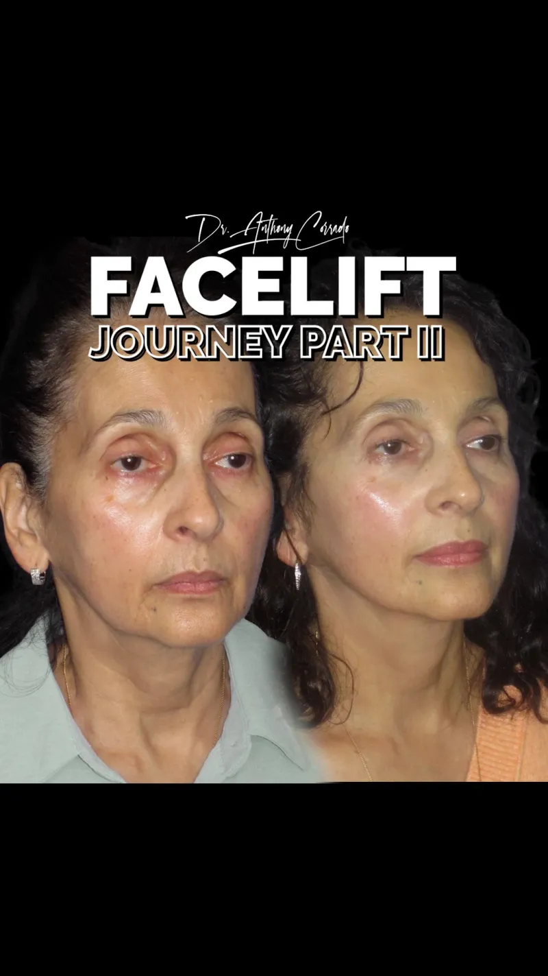 Before and after: Dr. Anthony Corrado