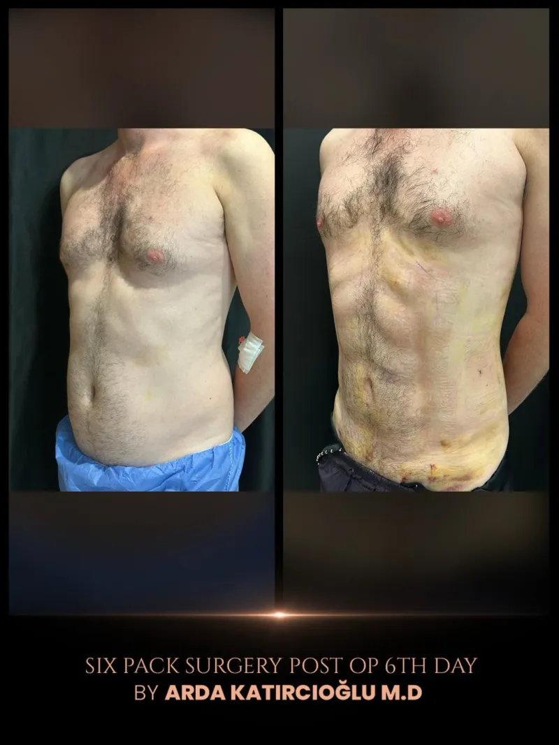 Before and after — Dr. Arda Katırcıoğlu