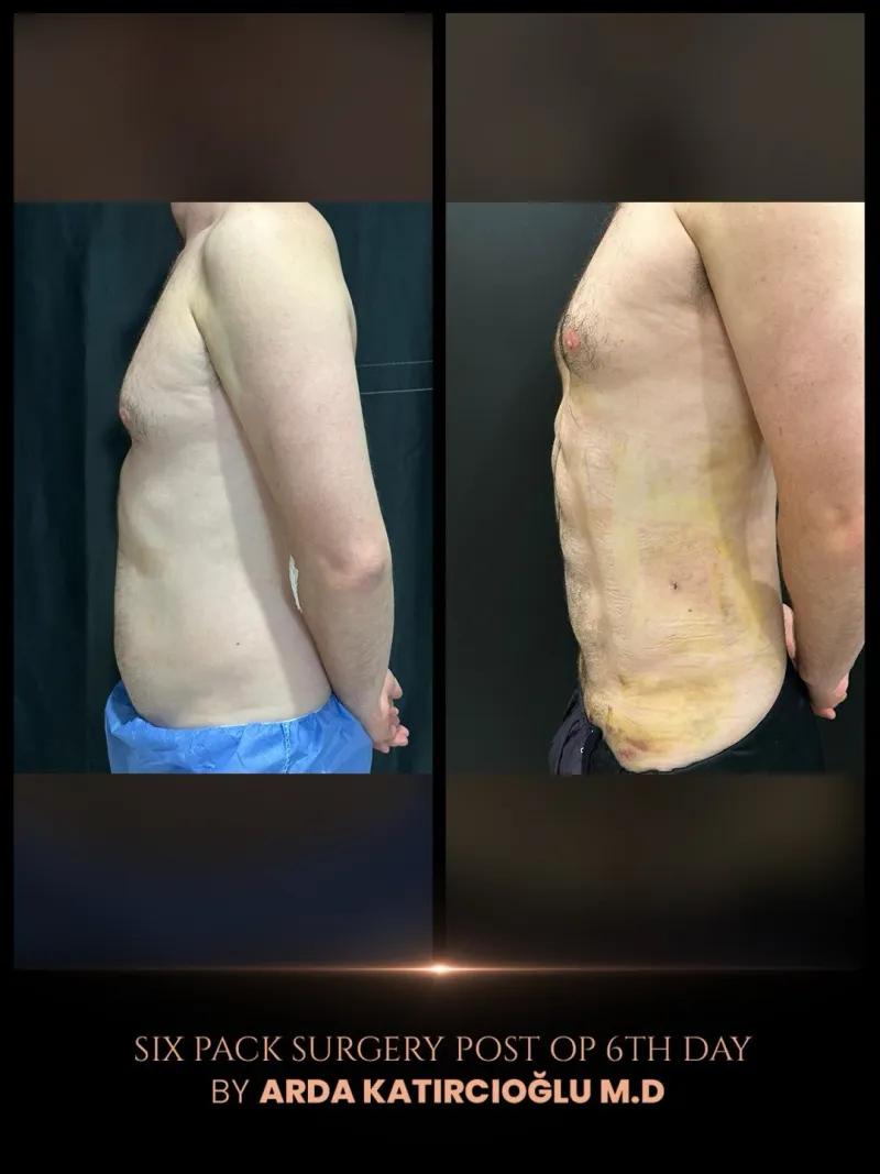 Before and after — Dr. Arda Katırcıoğlu