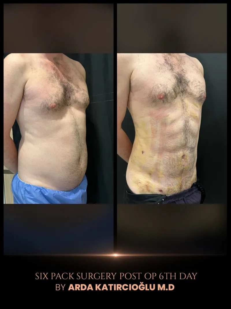 Before and after — Dr. Arda Katırcıoğlu
