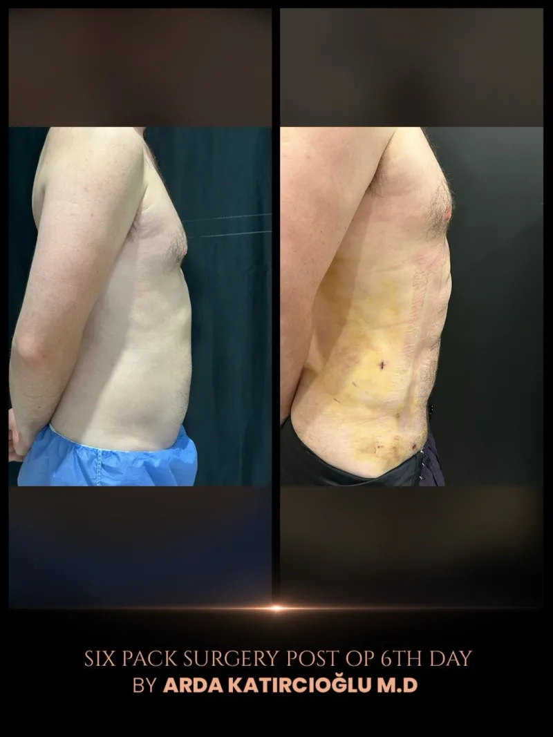 Before and after — Dr. Arda Katırcıoğlu