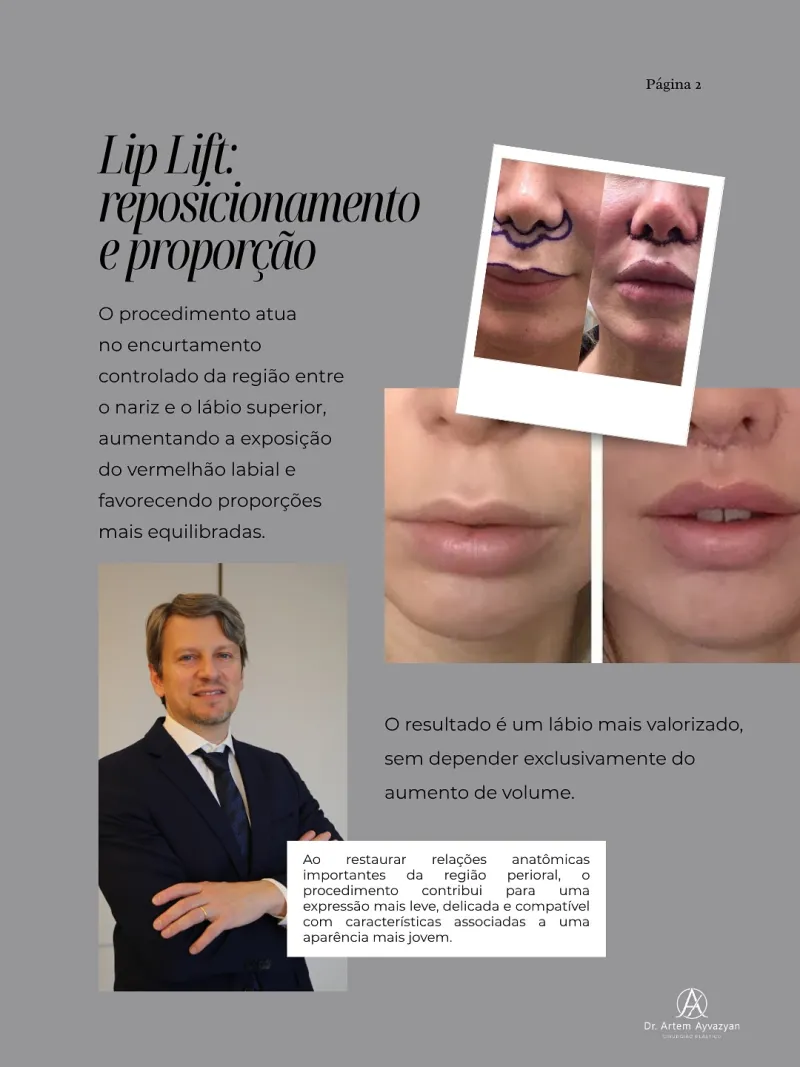 Before and after: Dr. Artem Ayvazyan