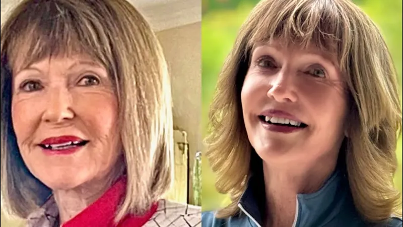 Before and after — Dr. Arthur Handal