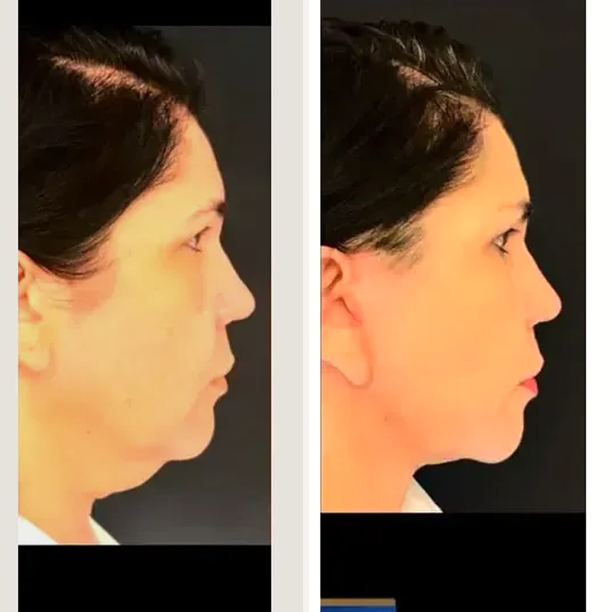 Before and after: Dr. Artur Grinfeld