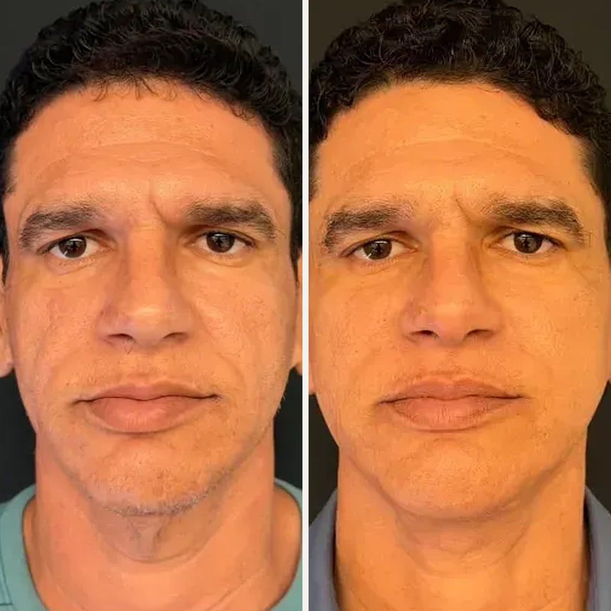 Before and after: Dr. Artur Grinfeld