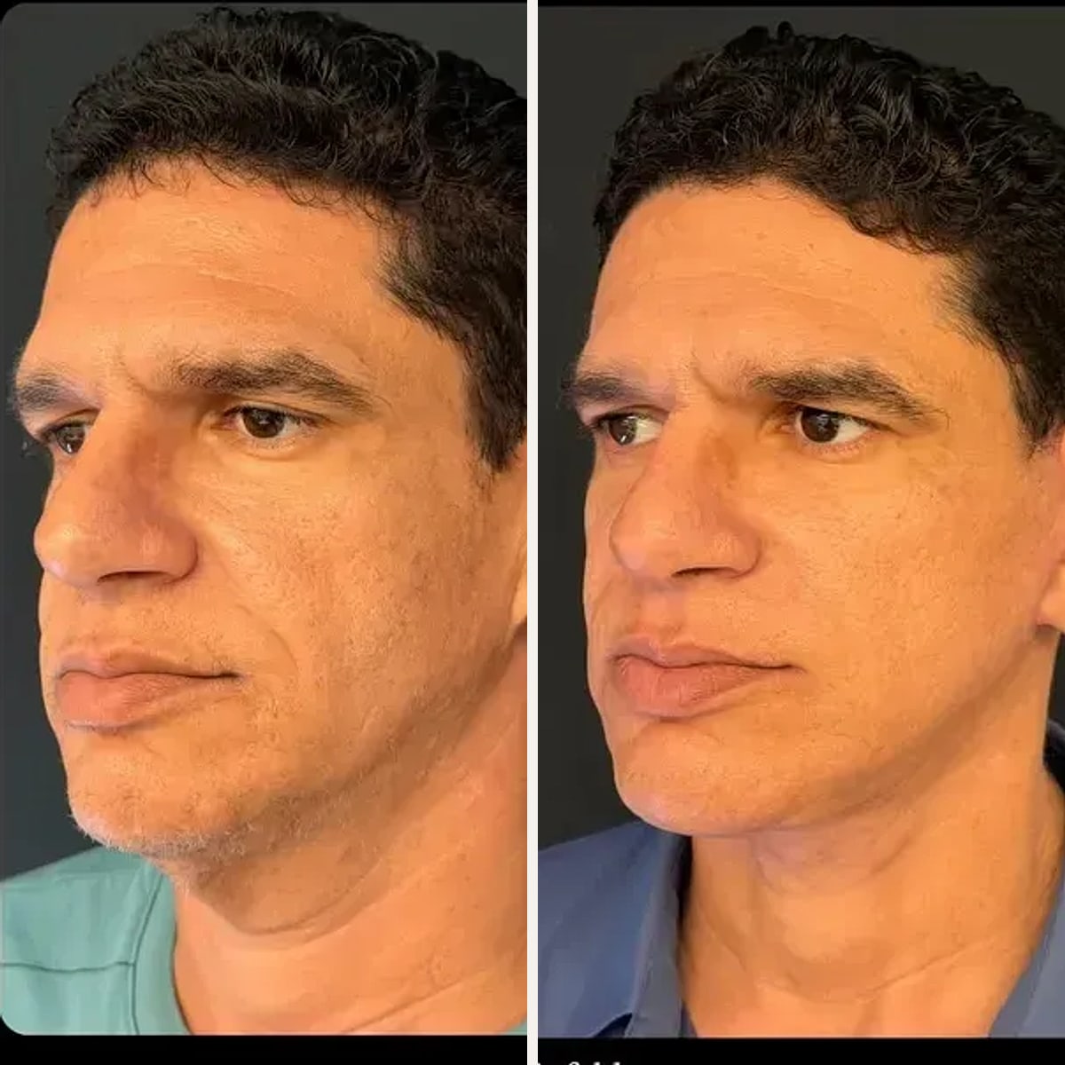 Before and after: Dr. Artur Grinfeld