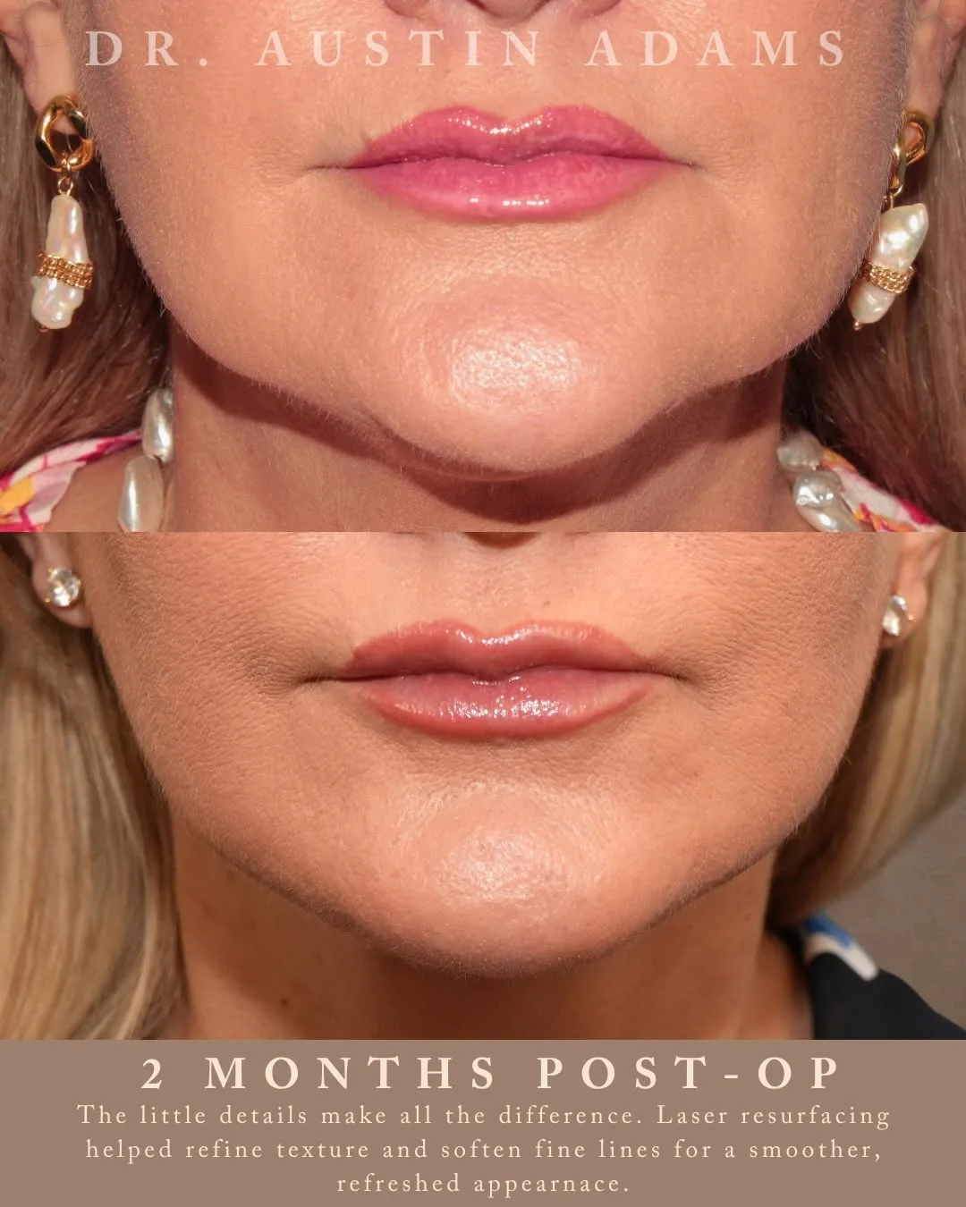 Before and after — Dr. Austin Adams