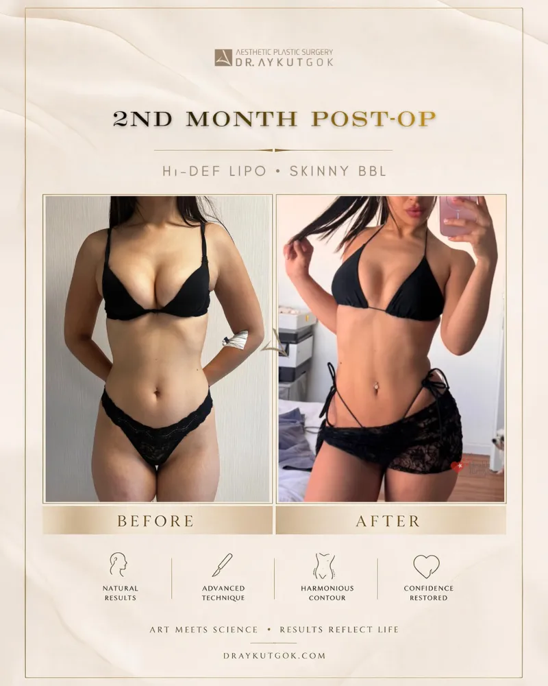 Before and after — Dr. Aykut Gök