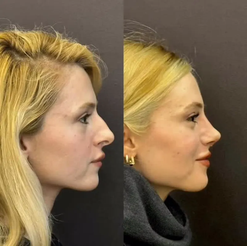 Before and after — Dr. Aykut Taşdemir