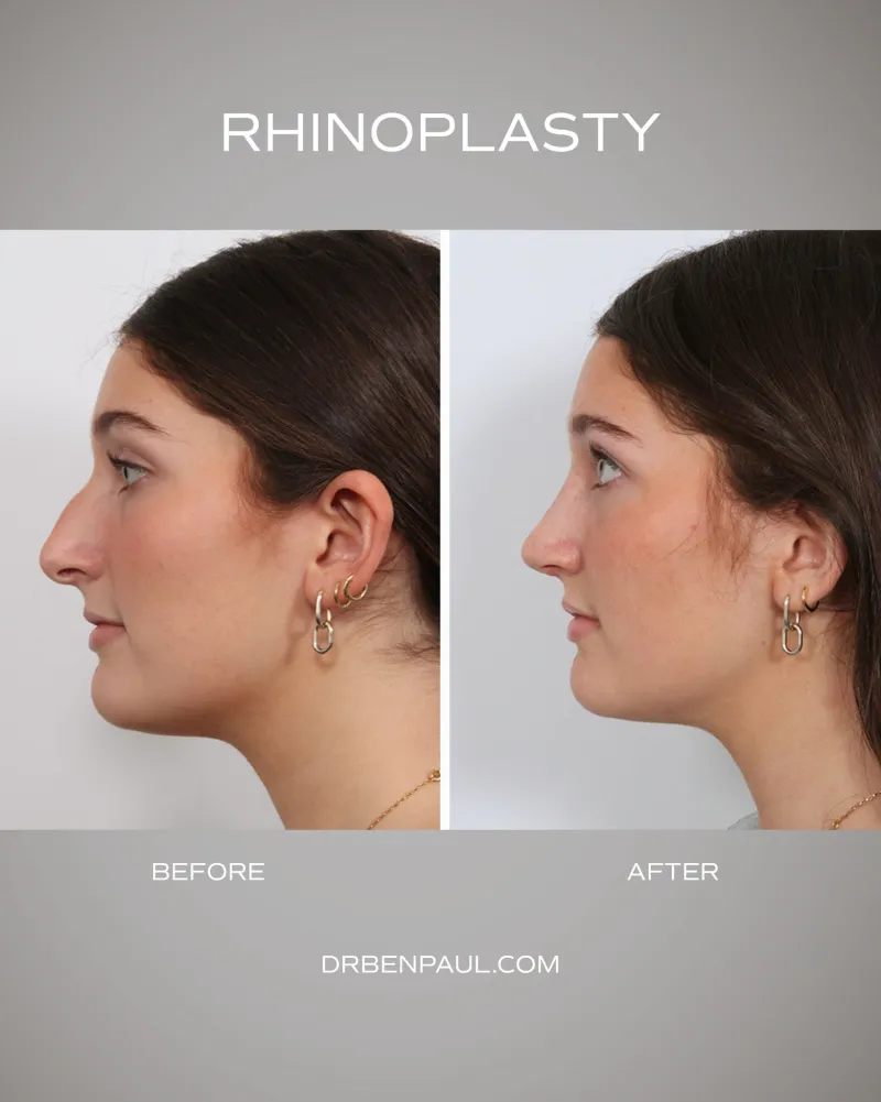 Before and after — Dr. Benjamin Paul