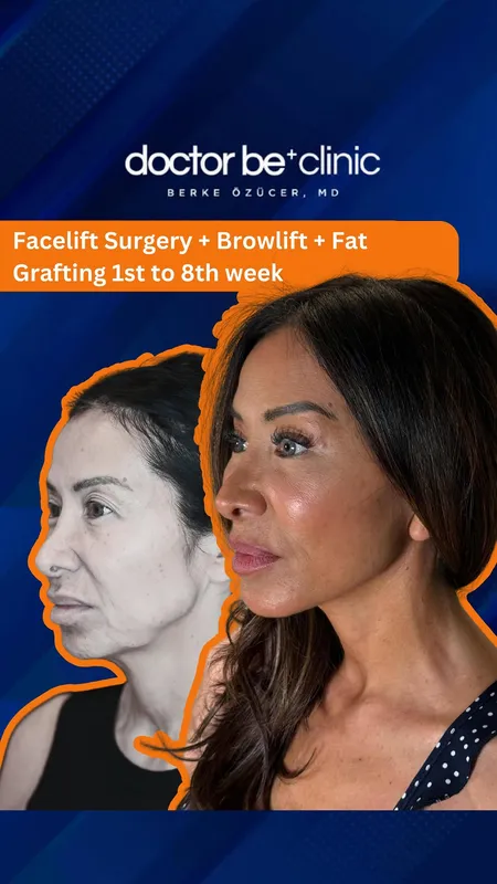 Before and after — Dr. Berke Özücer