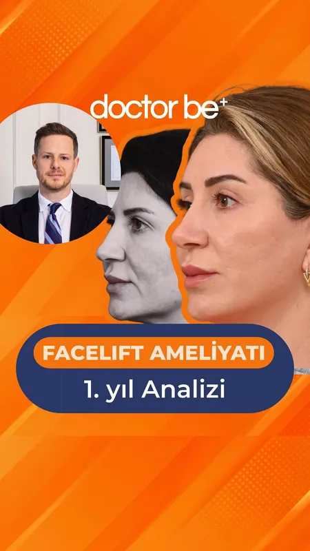 Before and after — Dr. Berke Özücer