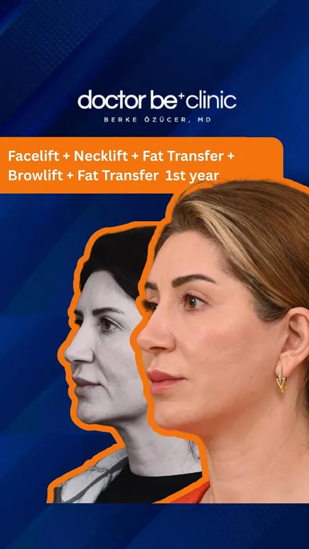 Before and after — Dr. Berke Özücer