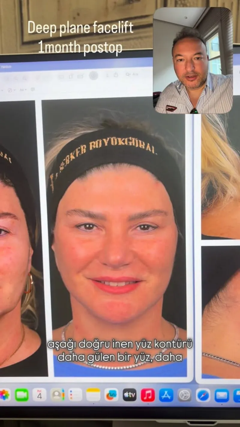 Before and after: Dr. Berker Büyükgüral