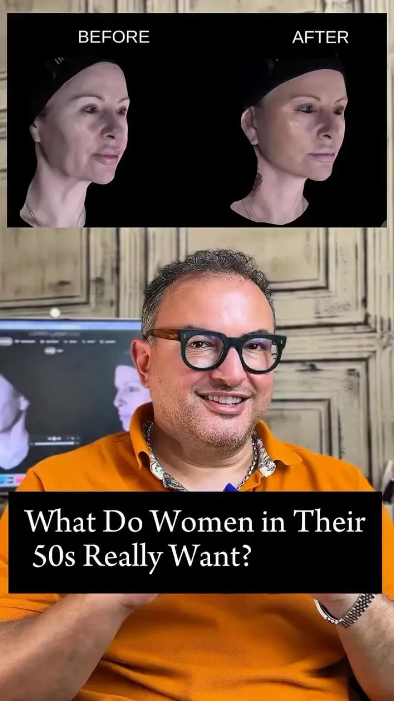 Before and after: Dr. Berker Büyükgüral