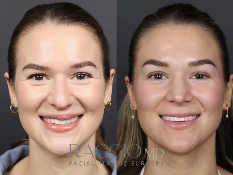 Before and after: Dr. Blake Raggio