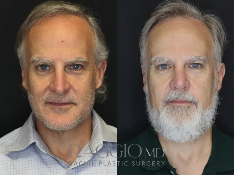 Before and after: Dr. Blake Raggio