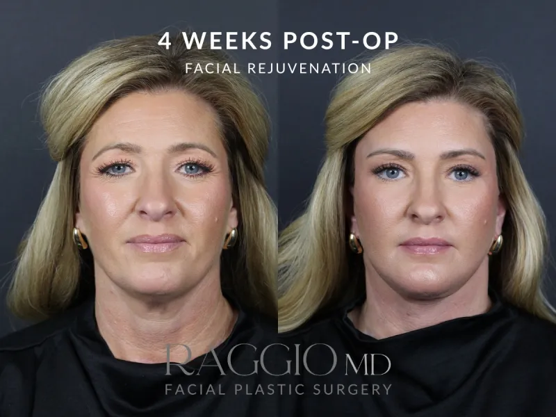 Before and after: Dr. Blake Raggio