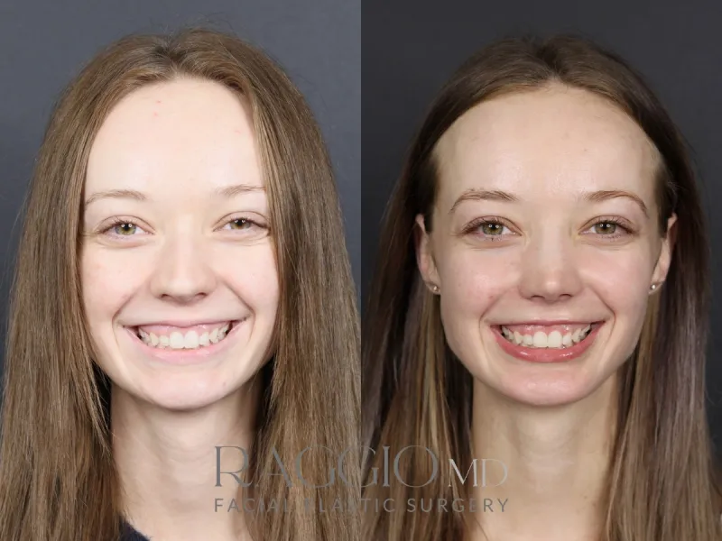 Before and after: Dr. Blake Raggio