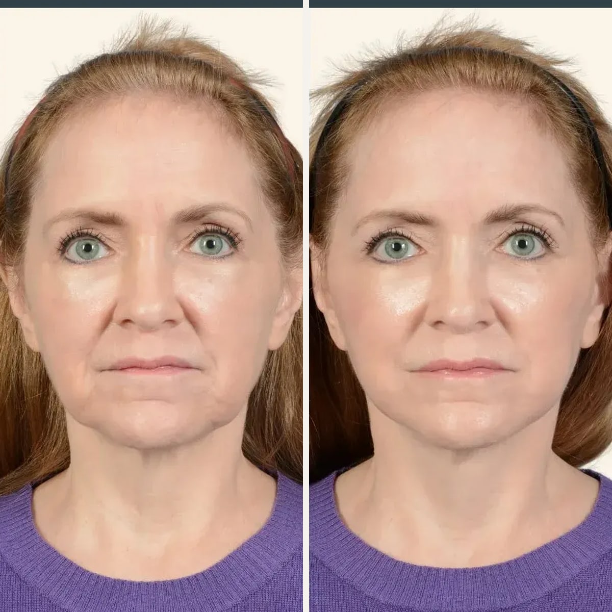 Before and after: Dr. Bradley Patt