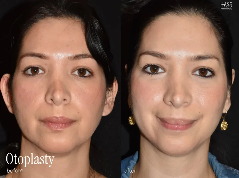Before and after — Dr. Brian Hass