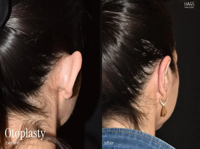 Before and after — Dr. Brian Hass