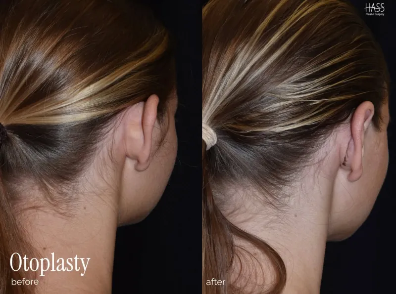 Before and after — Dr. Brian Hass