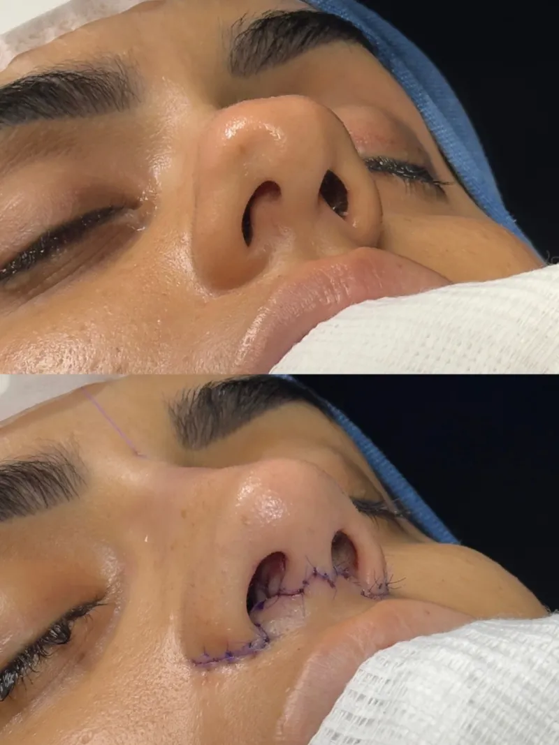 Before and after — Dr. Bruno Barros