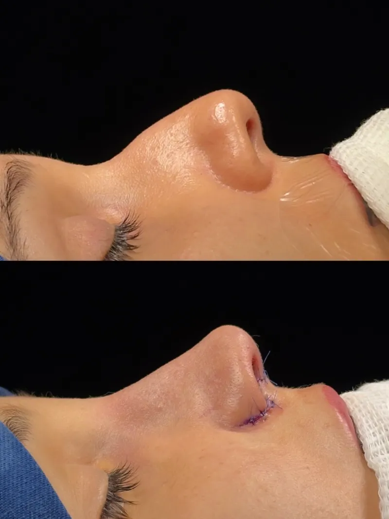 Before and after — Dr. Bruno Barros
